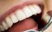 دندان,اثرات مخرب نوشابه و قهوه بر سلامت دندان‌ها