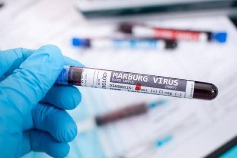 ویروس ماربورگ,سازمان جهانی بهداشت