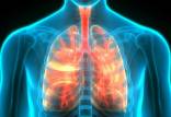 ریه,ابداع نانوذرات جدید با توانایی انتقال مستقیم ژن‌درمانی به ریه