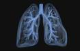 ریه,ویرایش ژن در ریه‌ها با کمک نانوذرات