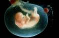 پیش‌بینی سقط جنین با کمک هدست واقعیت مجازی,ابداع هدست واقعیت مجازی برای پیش‌بینی سقط جنین