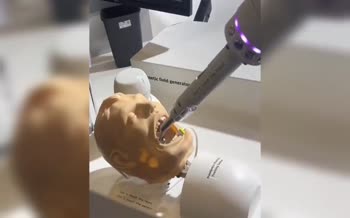 فیلم/ اولین تست‌های ربات دندان‌پزشک؛ دندان‌پزشک‌ها بیکار می‌شوند؟