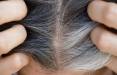 سفید شدن مو,کشف روشی برای جلوگیری از سفید شدن موها