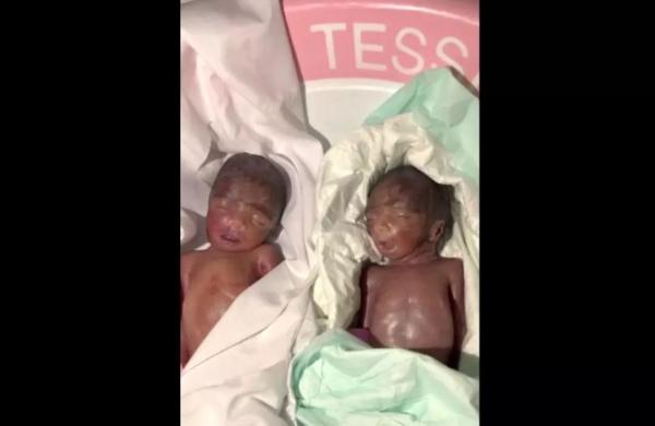 فوت نوزادان به دلیل قصور پزشکی,ماجرای مرگ مشکوک نوزادان دوقلو در سیستان و بلوچستان