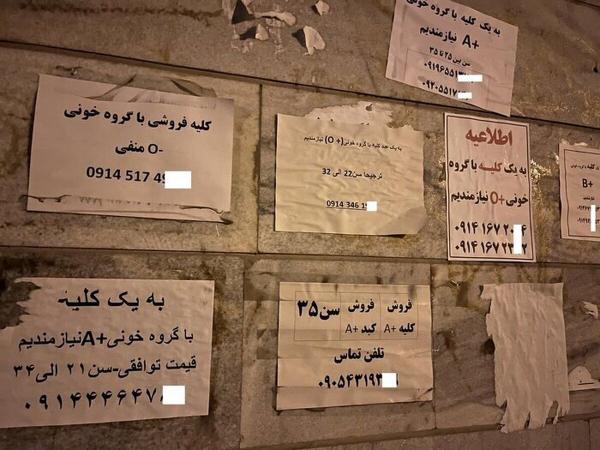 فروش اعضای بدن,فروش دلاری اعضای بدن ایرانی‌ها با سفر به ترکیه و عراق