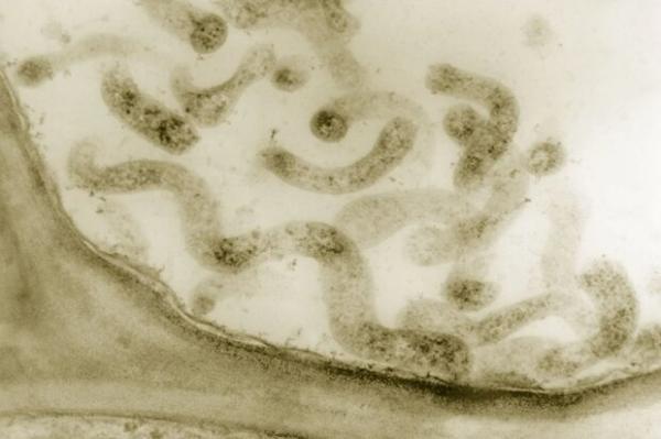 باکتری,ارتباط مهم عفونت باکتریایی با بروز بیماری اِندومتریوز