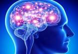 مغز,عوامل کوچک کردن مغز