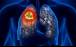 سرطان ریه,کاهش خطر مرگ بیماران مبتلا به سرطان ریه با قرص Osimertinib