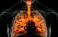ریه,موفقیت محققان در نابودی برخی سلول‌های عامل بیماری ریوی
