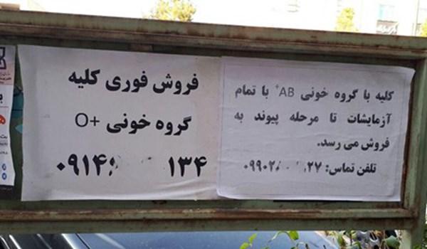 فروش اعضای بدن,سایت خرید و فروش اعضای بدن در ایران