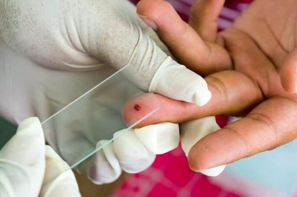 بیماری مالاریا,شناسایی پنج فرد مُبتلا به مالاریا در اصفهان