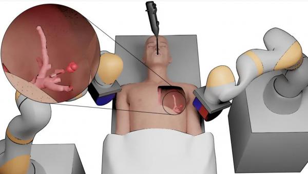 رباتی برای ورود به ریه,رباتی با توانایی درمان سرطان