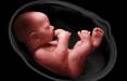 سقط جنین,ممنوعیت سقط جنین قانونی