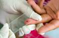 بیماری مالاریا,شناسایی پنج فرد مُبتلا به مالاریا در اصفهان