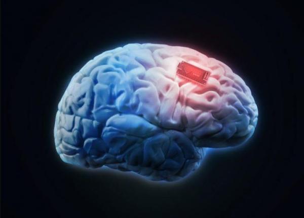 تراشه مغزی,کاشت آزمایشی تراشه مغزی برای بیماران فلج