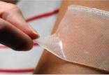 پانسمان,درمان زخم‌های سوختگی و بستر با پانسمان‌های شفاف نانو فیبری