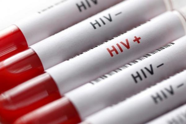 HIV در ایران HIV در ایران, ابتلا به اچآیوی,راههای انتقال ویروس اچآیوی