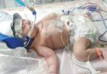 فوت یک نوزاد بخاطر قصور پزشکی,فوت یک نوزاد در بیمارستان علیمرادیان نهاوند
