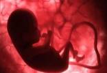 باردرای,مضرات دود اگزوز خودروبرای زنان باردار