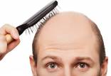ریزش مو,شناسایی ژن‌های نادر عامل ریزش موی مردان