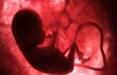 باردرای,مضرات دود اگزوز خودروبرای زنان باردار
