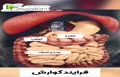 فرایند گوارش و هضم غذا در بدن به این صورت است +فیلم