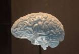 مغز,ثبت سیگنال قدرتمند در ماده سفید مغز