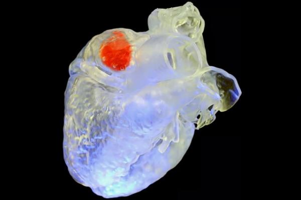 چاپ ۳ بعدی اندام,چاپ ۳ بعدی اندام در داخل بدن با استفاده از فناوری فراصوت