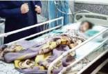 شکنجه دختربچه ارومیه‌ای به دست نامادری,شکنجه دختر توسط نامادری