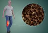 پوکی استخوان,نقش آلودگی هوا در افزایش ریسک ابتلا به پوکی استخوان