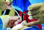 عمل‌های جراحی زیبایی,قیمت‌های عجیب و غریب جراحی زیبایی