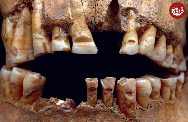 بدن های اصلاح شده,جمجمه کشیده و مردانی با دندان شیاردار