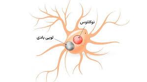 سلول‌های مغزی,اثر انگشت مرتبط با پارکینسون