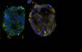 مرگ سلول‌های سرطانی,ژن Schlafen11, فرآیند مرگ سلول‌ها