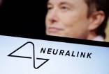 ایلان ماسک,کاشت تراشه در مغز دومین بیمار