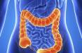 سرطان روده,کشف دارویی جدید برای درمان سرطان روده بزرگ