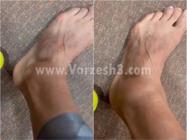 رامین رضاییان رامین رضاییان,مصدومیت رامین رضاییان