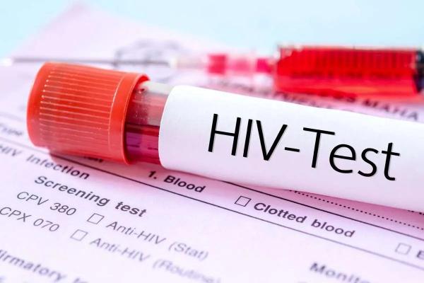 پیشرفت مهم در مسیر درمان «HIV» پیشرفت مهم در مسیر درمان «HIV» ,HIV