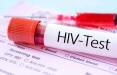 پیشرفت مهم در مسیر درمان «HIV» ,HIV