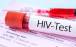 پیشرفت مهم در مسیر درمان «HIV» ,HIV