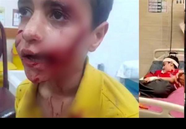 کودک ۱۱ ساله مسجدسلیمانی,حمله سگ ولگرد به کودکی در مسجد سلیمان