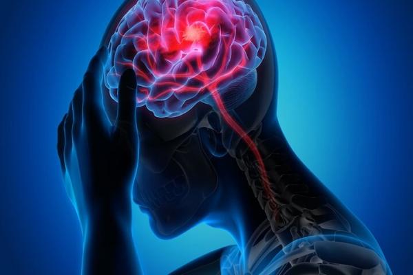 سکته مغزی,تایید ارتباط عجیب برداشتن رحم با سکته مغزی