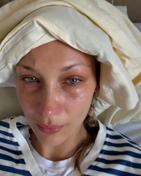 بلا حدید بلا حدید,بیماری بلا حدید