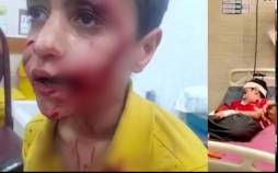 کودک ۱۱ ساله مسجدسلیمانی,حمله سگ ولگرد به کودکی در مسجد سلیمان