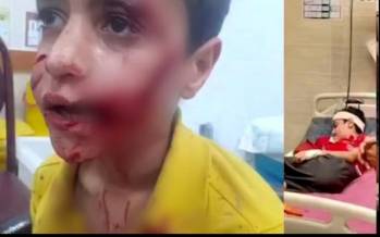 کودک ۱۱ ساله مسجدسلیمانی,حمله سگ ولگرد به کودکی در مسجد سلیمان