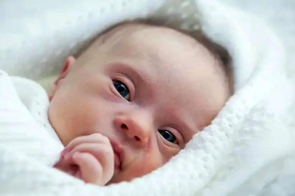 نوزادان مبتلا به اختلالات کروموزومی,نوزادان کروموزومی
