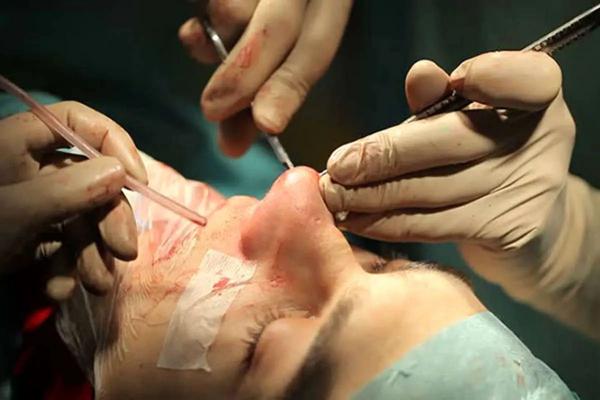 مرگ یک دختر در کلینیک زیبایی,افشای راز مرگ دختر 25 ساله در کلینیک غیرمجاز زیبایی