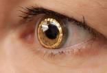ایمپلنت چشمی,درمان نابینایی با ایمپلنت چشمی