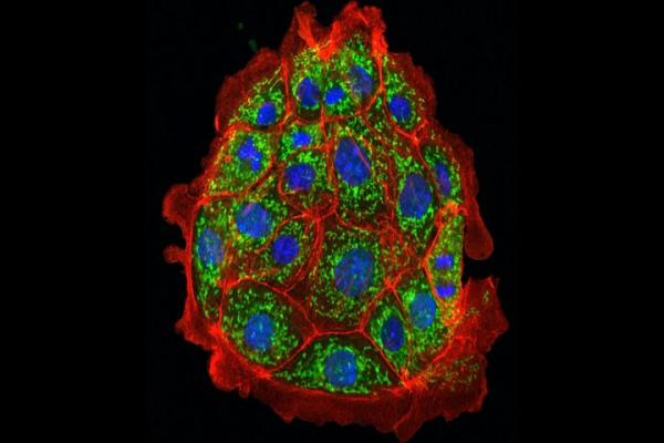 کلیوی کلیوی,آسیب کلیوی