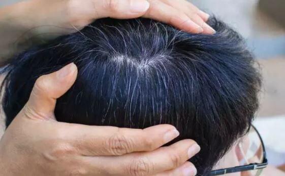 سفیدی مو سفیدی مو,یافتهای جدید درباره سفید شدن مو
